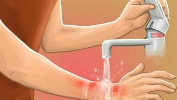 فيديوهات حول الاسعافات الاولية للاطفال
